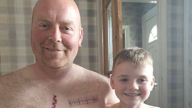 El emotivo gesto de un padre hacia su hijo: se tatúa su misma cicatriz para que no se sienta diferente