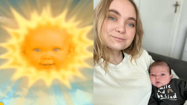 El antes y el después de Jess Smith, el 'bebé sol'