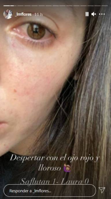 Secuelas enfermedad Laura Matamoros en el ojo