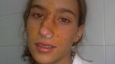 El mensaje de María Pombo a las niñas tras la polémica de su operación de nariz