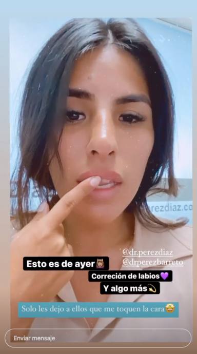Isa muestra su retoque de labio en Instagram