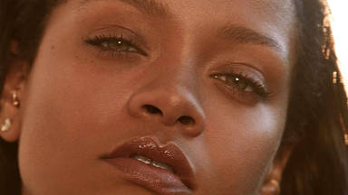 Rihanna acaba con una multitud de marcas y moratones en su rostro tras un accidente muy extraño