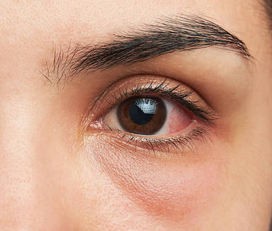 Com evitar i alleujar els ulls secs o irritats